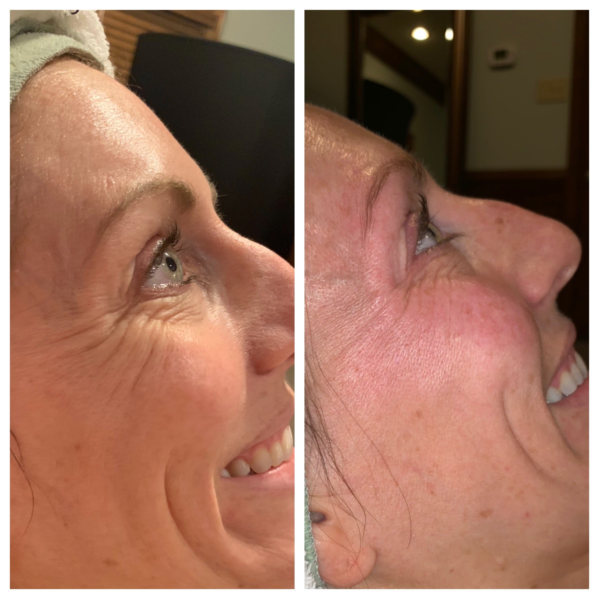 Restoracell with Copper Peptides, a Great Partner for Microneedling Vitali Skincare Restoracell with Copper Peptides, a Great Partner for Microneedling Vitali Skincare